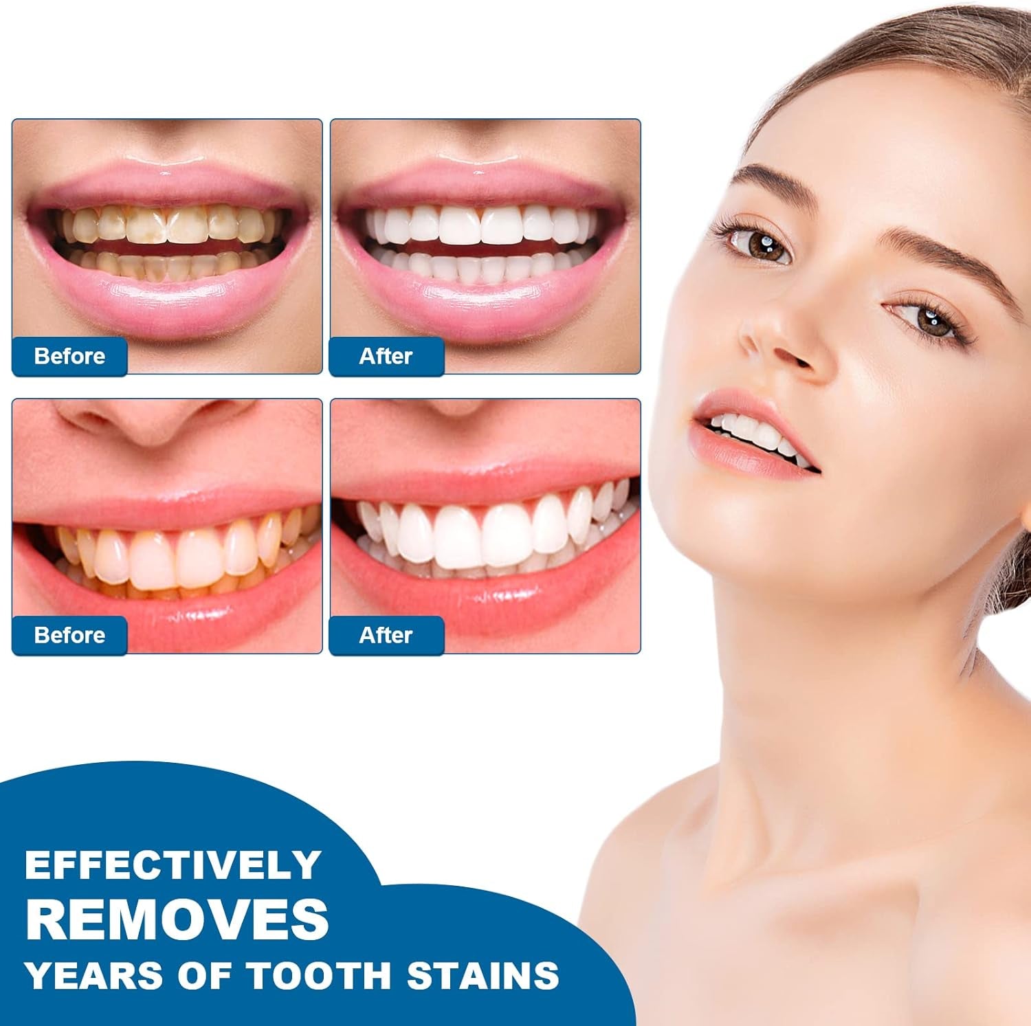 Teeth Whitening Pen,Teeth Whitening Essence,Teeth Whitening Gel,Teeth Stain Remover to Whiten Teeth,Intensive Stain Removal Teeth Reduce Yellowing (2Pcs)